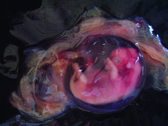 placenta refeita.jpg (1.11 MB)