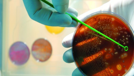 Contagem bacteriana total: Entendendo o processo de análise