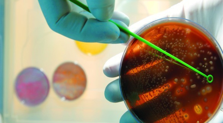 Contagem bacteriana total: Entendendo o processo de análise